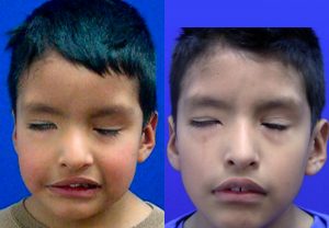 clinica-nervio-facial-casos-de-exito
