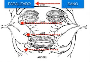 anderl
